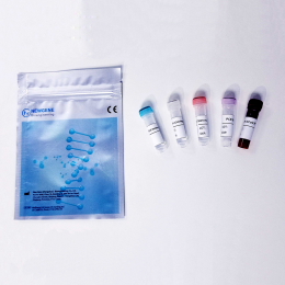Novel Coronavirus (2019-nCoV) Ribonucleic Acid Detection Kit (Real-time PCR - Fluorescent Probe Assay)